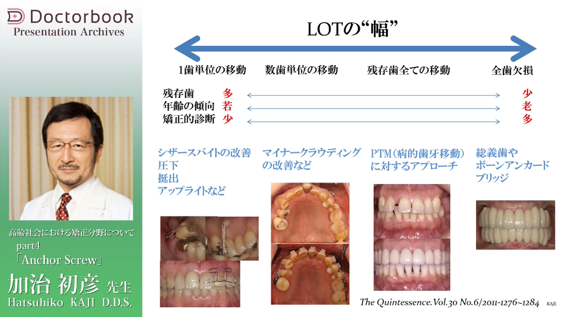 最新の矯正治療を知ろう～GPにも必要な矯正の知識～ | Doctorbook